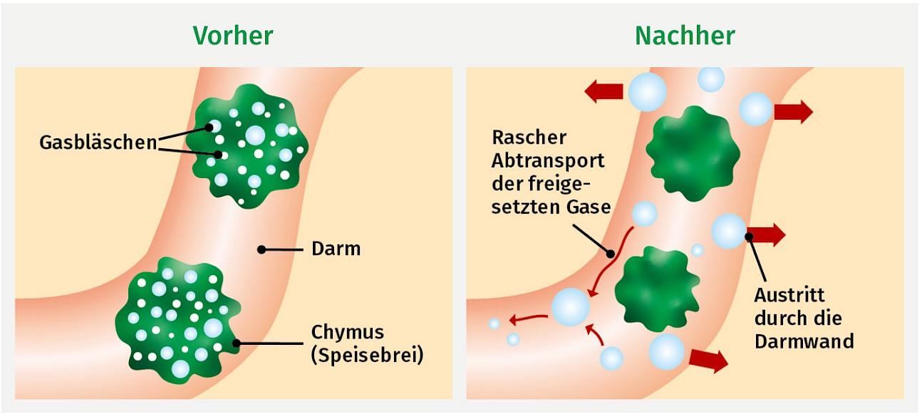 Vorher Nachher